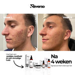 Signature Men's Skincare Set: Cleanse, Exfoliate, Repair & Hydrate