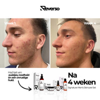 Signature Men's Skincare Set: Cleanse, Exfoliate, Repair & Hydrate